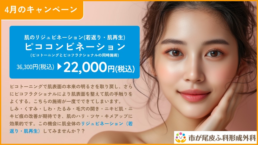 キャンペーン